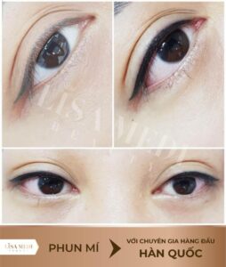 Kết quả phun thêu mí mắt tại LISA MEDI