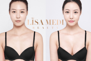 lisamed