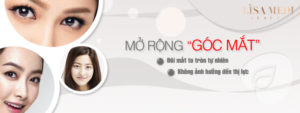 Mở rộng góc mắt với Lisa Medi