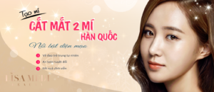 Cắt mí hàn quốc