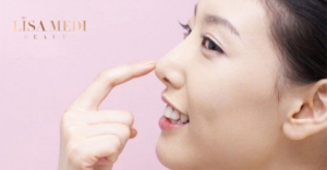 Chỉnh mũi phức hợp tại Hàn