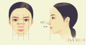Chỉnh hình mũi phức hợp