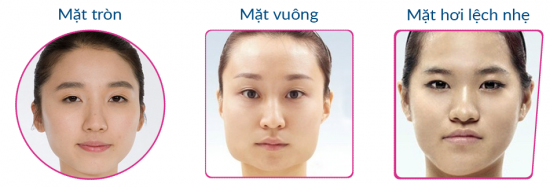 Phẫu thuật gọt hàm tại LISA MEDI